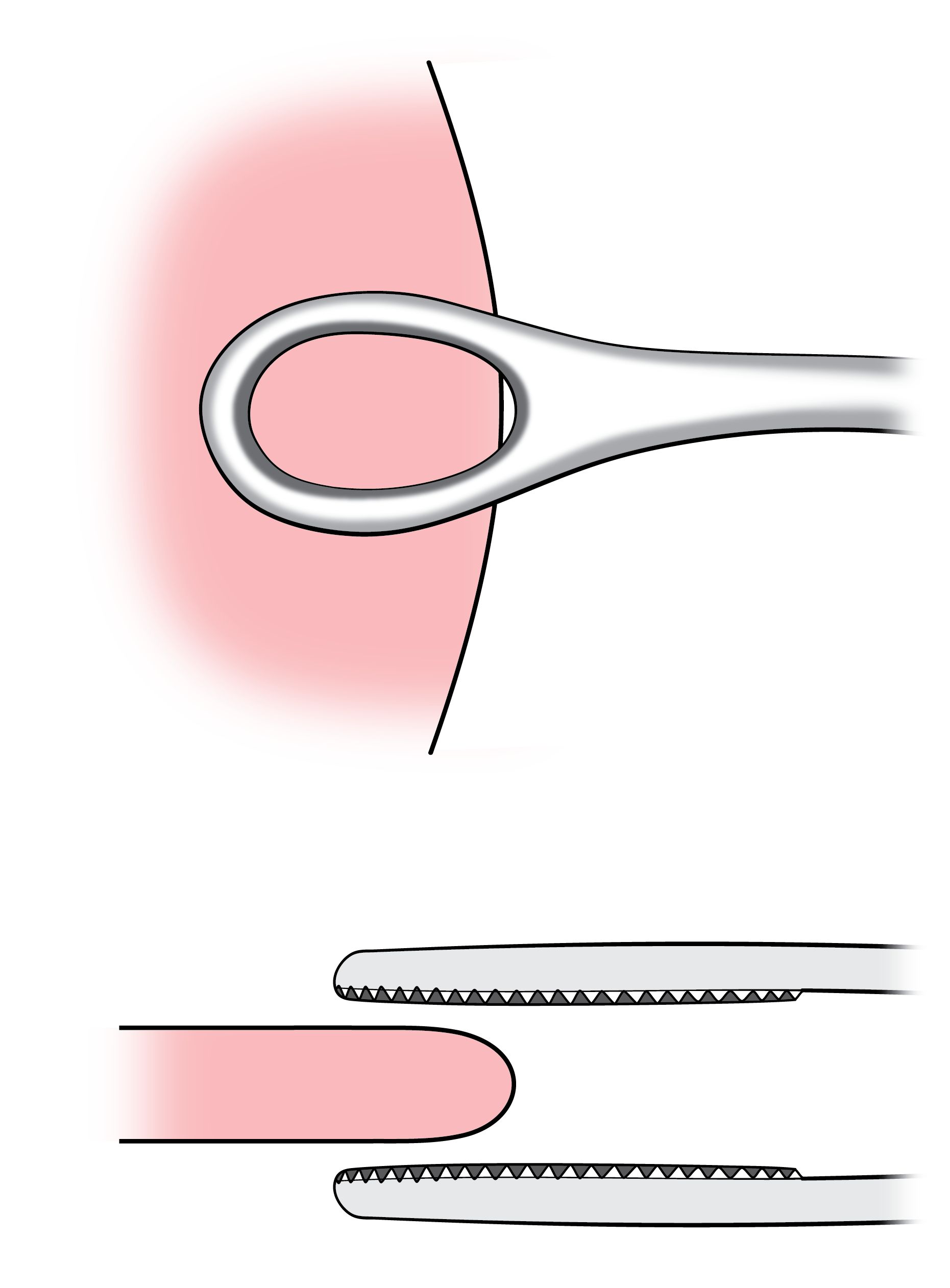 Perpendicular alignment