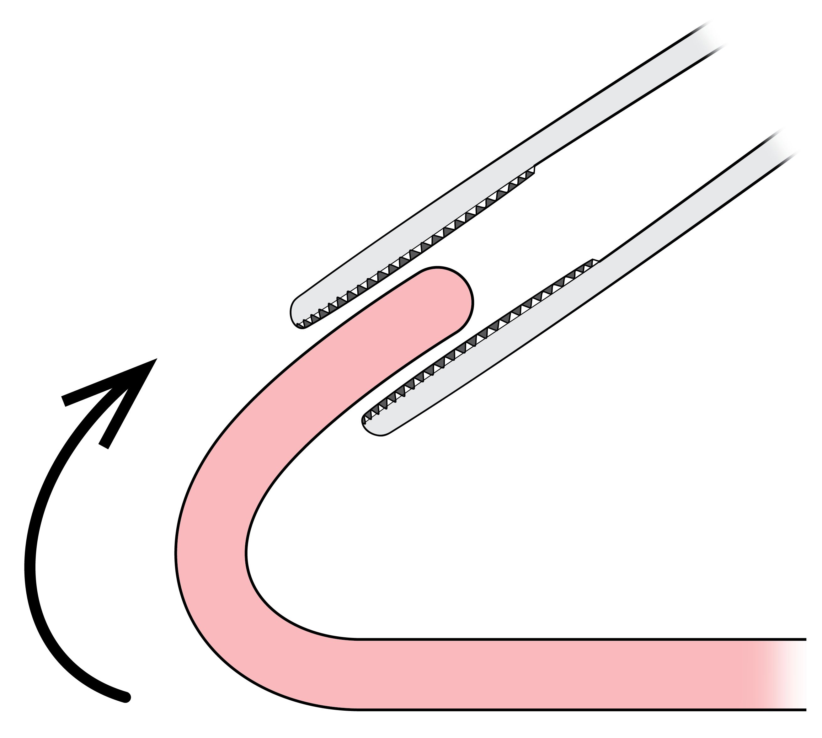 Retracting the edge into position for grasping
