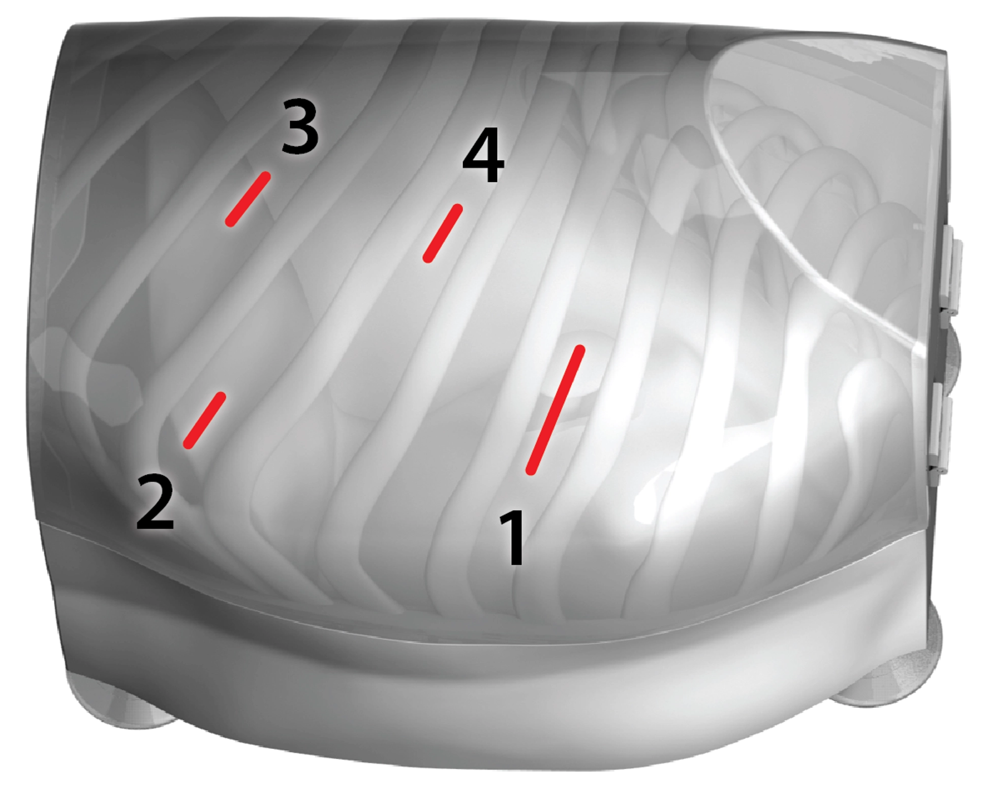 Standard locations of access incisions