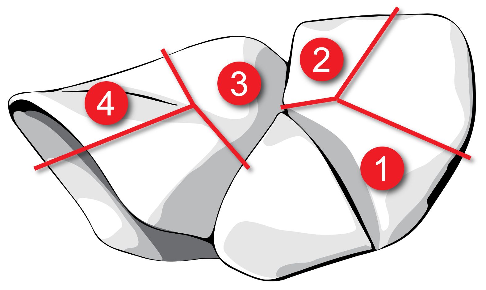 Recommended sequence of segmentectomies